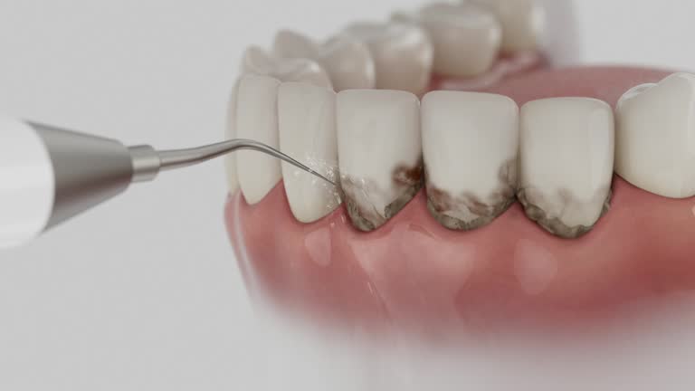 Trusted Dental Crowns And Bridges service in Deenwood, GA - Dentist Open Now